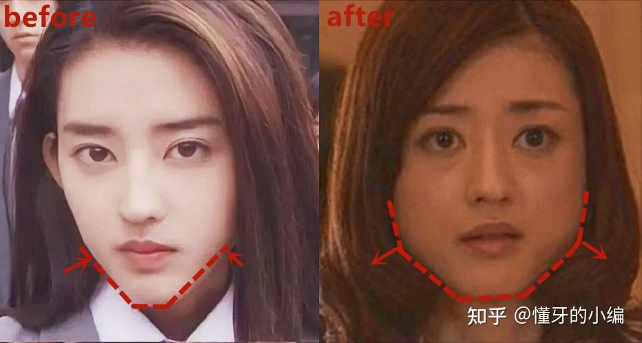 男生发腮后有什么办法拯救? - 知乎
