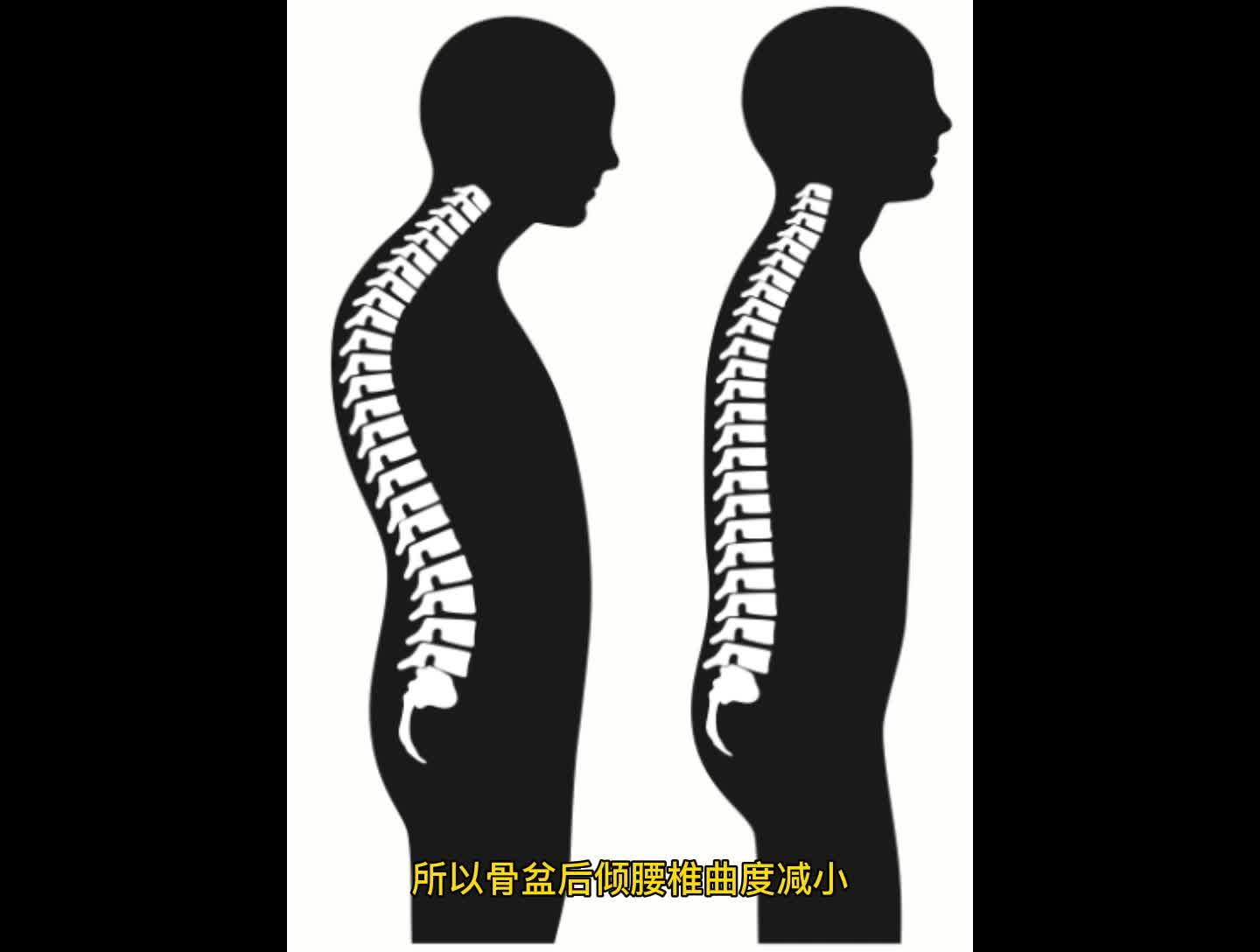 腰椎曲度变直的3个自我矫正训练,还你完美腰线和腰曲