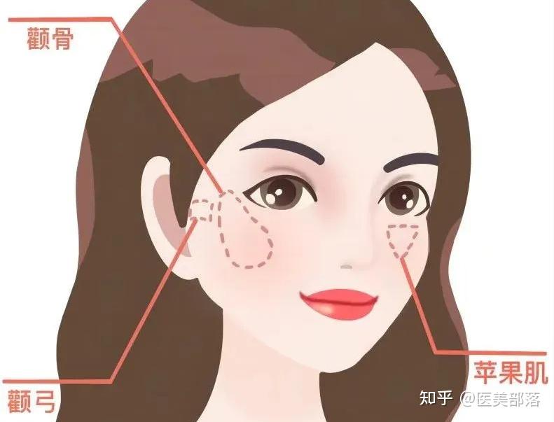 一招教你分清90%的人都分不清的「颧骨、颧弓、苹果肌」! - 知乎