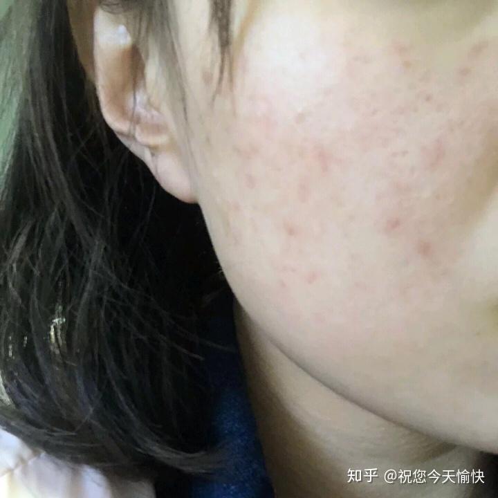 v2-e833ab285629cf8aa355045d1e022864_r.jpg