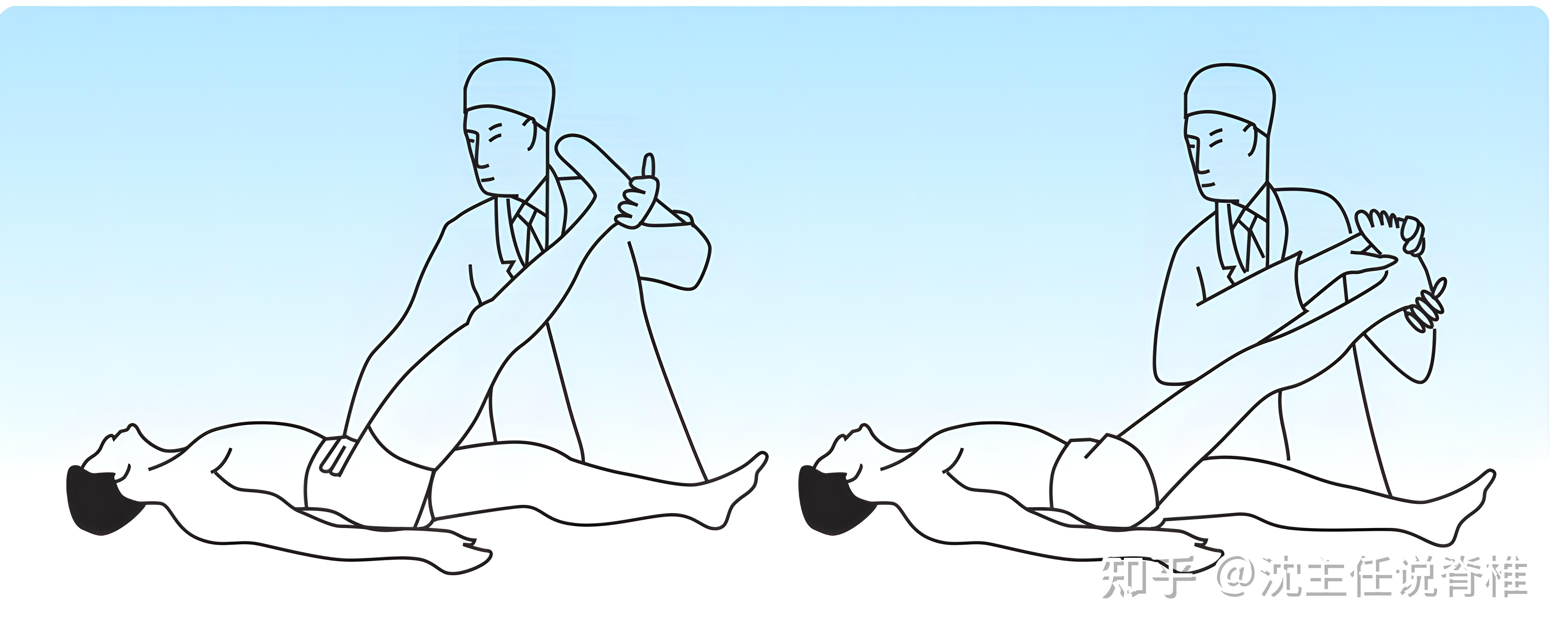 试验:直腿抬高在60°以前出现疼痛,超过60°后疼痛减轻,说明是梨状肌