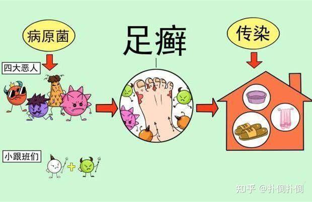 腳氣根治方法腳氣這樣做既然能自愈