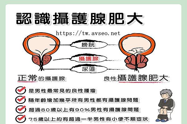 攝護腺肥大改善與保養 知乎