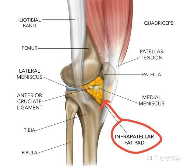 膝关节有4个脂肪垫,髌下脂肪垫,髌上囊脂肪垫,股骨前脂肪垫,腘脂肪垫