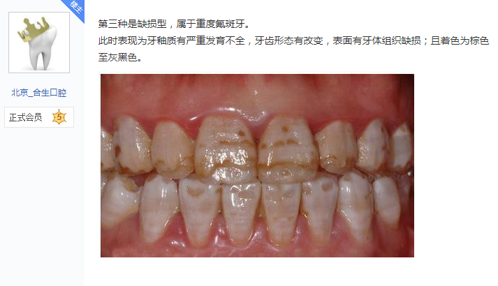 牙齿上有黄斑? - 知乎