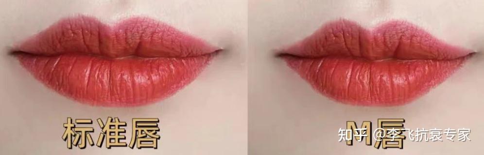 #李飞抗衰老#美人都是这种唇形---M唇(嘟嘟唇、微笑唇) - 知乎