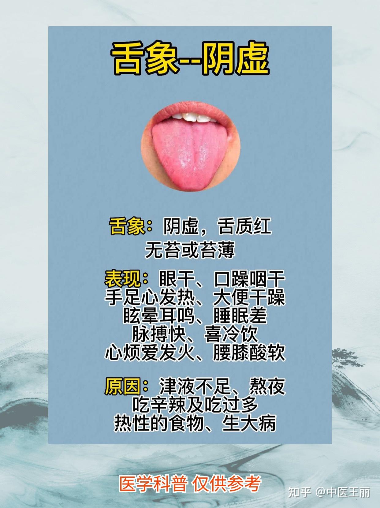 看舌象，知健康，中医教你分辨六种舌象，对比一下你有没有 - 知乎