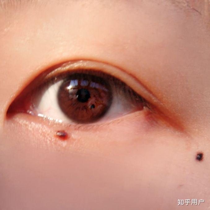 历史上的重瞳子是真实存在的吗?两个瞳仁在眼睛里是如何分布的?