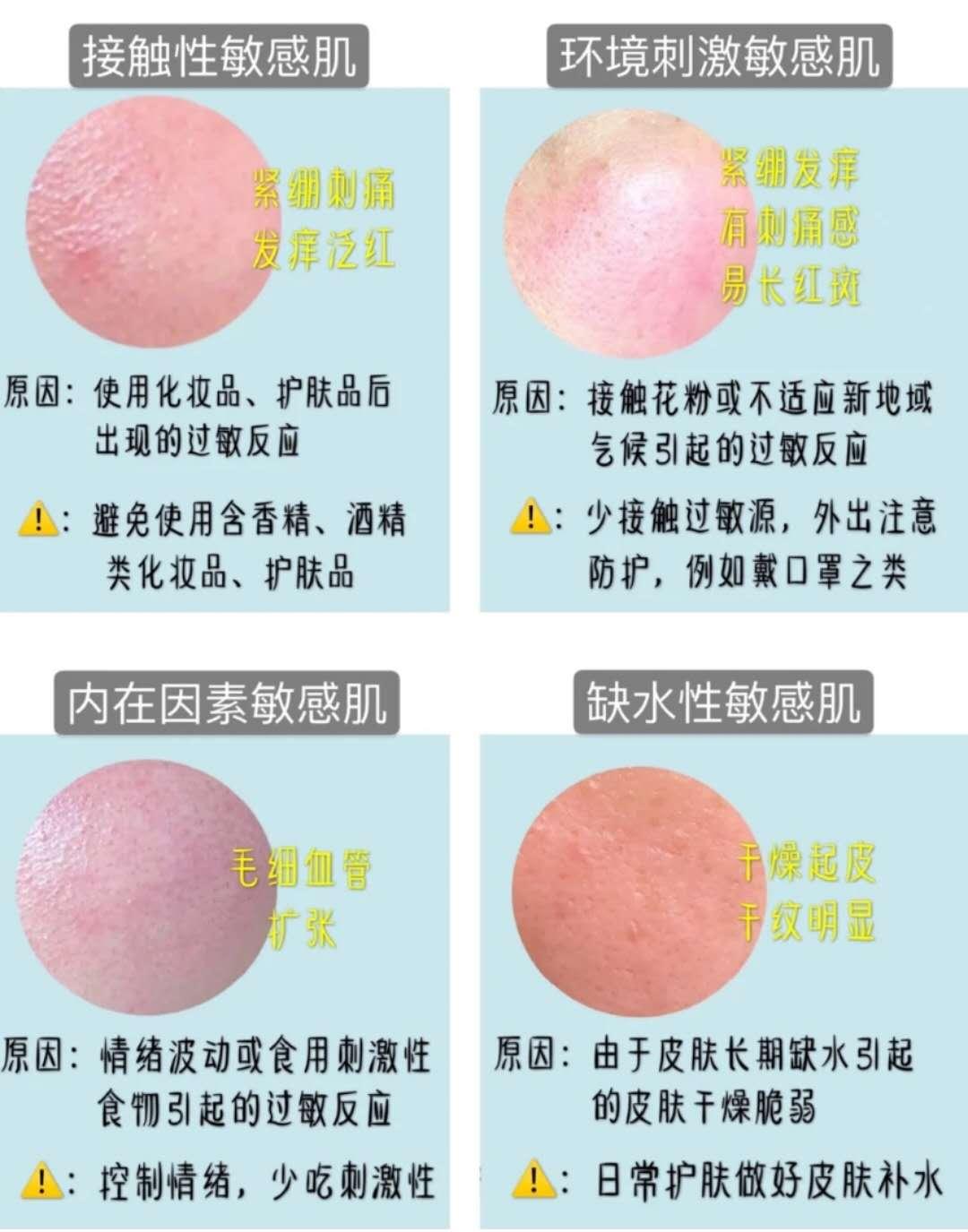 敏感肌公开课 拯救敏感肌 超全干货 知乎