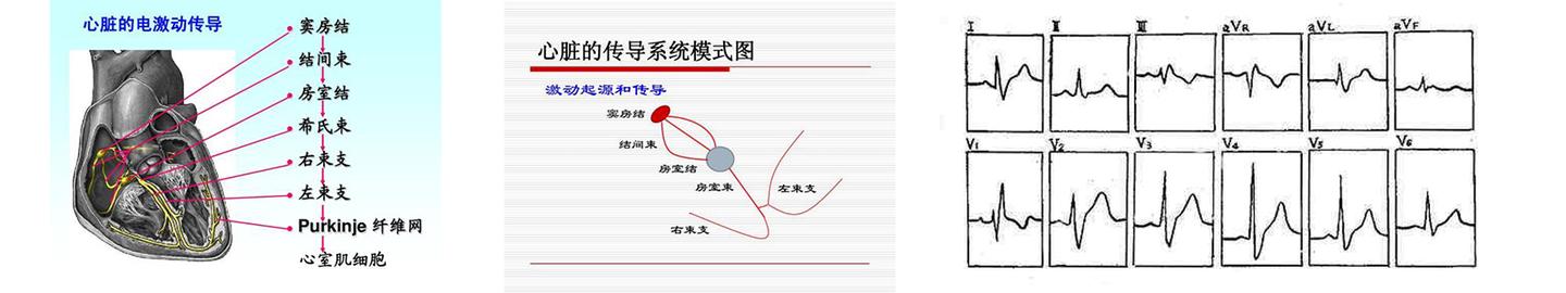 博声医疗 完全性右束支传导阻滞 知乎 博声医疗 完全性右束支传导阻滞 知乎