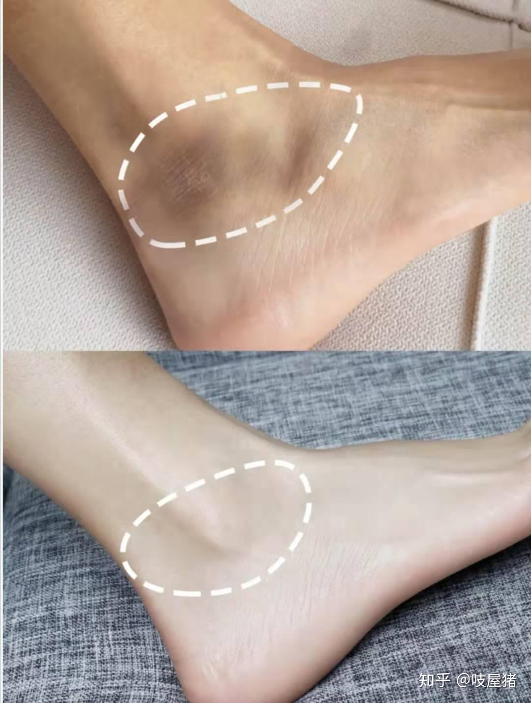 脚上天天涂身体乳可以吗(脚上天天涂身体乳可以吗女生) 脚上天天涂身体乳可以吗(脚上天天涂身体乳可以吗女生)