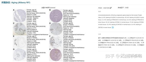 免疫组化常见问题及经验总结（二） - 知乎