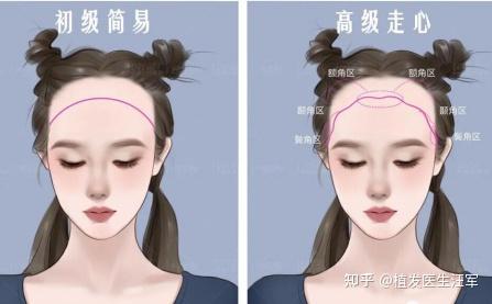 发际线美学∣什么样的发际线才是最适合你的? - 知乎
