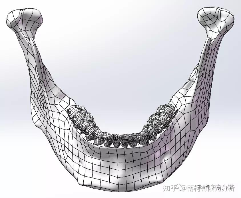 為什麼越來越多外科醫生青睞於術前三維重建