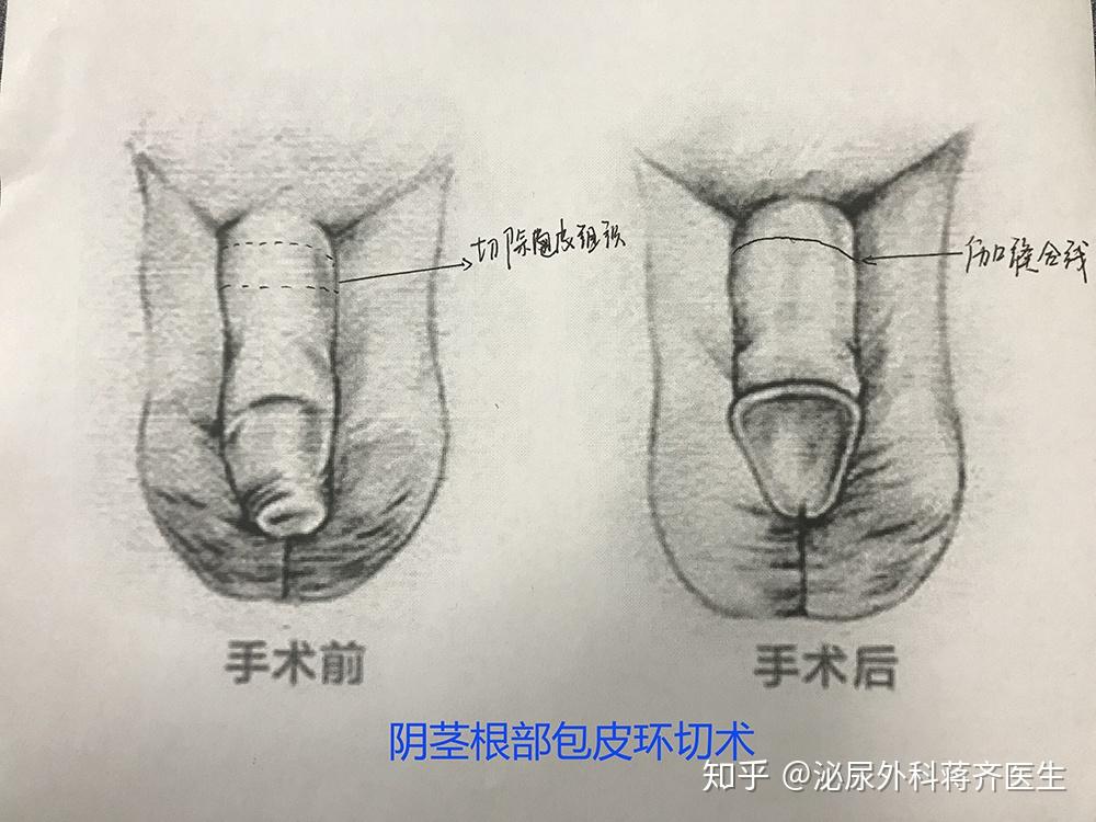 v2-ea146c8d581d209f67066ce3f0fe4af4_r.jpg
