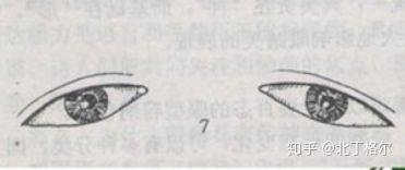 扫一扫识别眼型 v2-ea469250dfc906e79be2e08f41108ba4_b.jpg