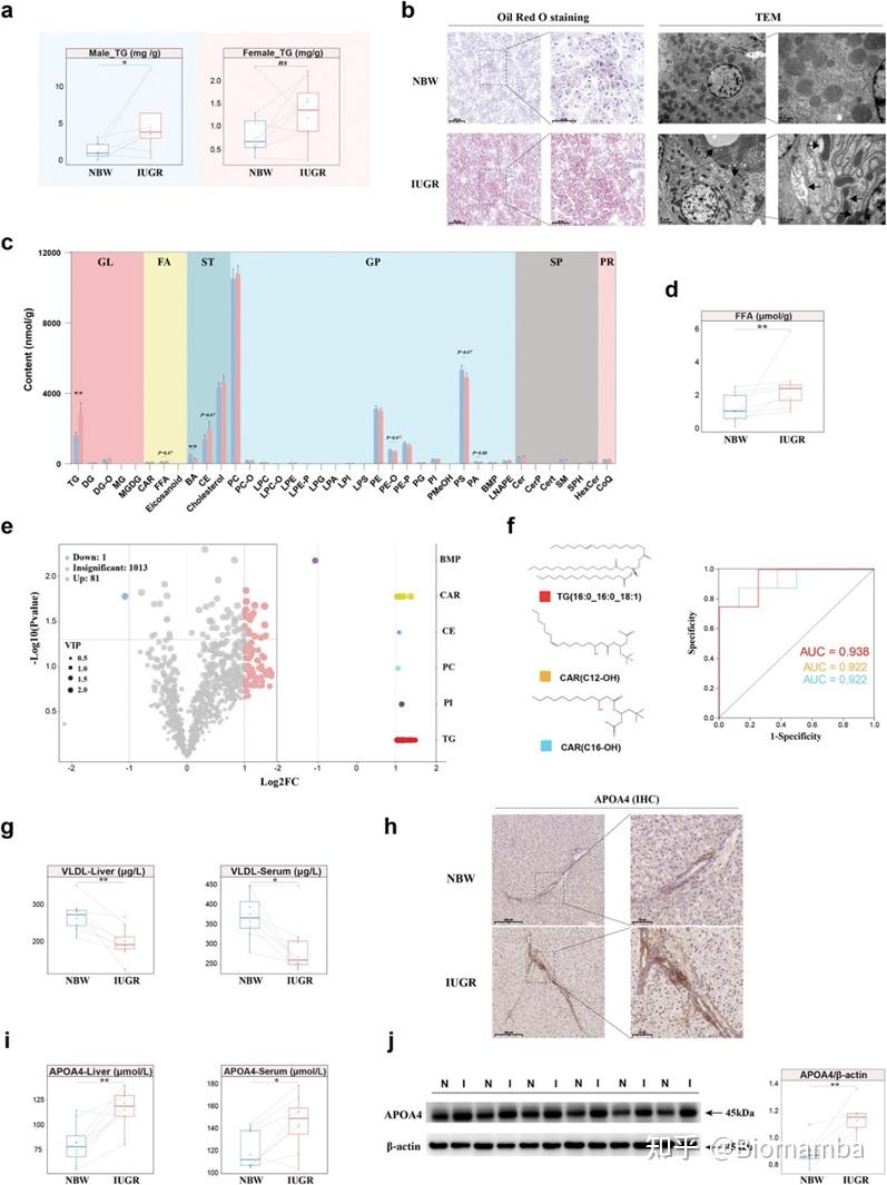 IF14.3| scRNA-seq+脂质组多组学分析揭示宫内生长受限导致肝损伤的性别差异 - 知乎