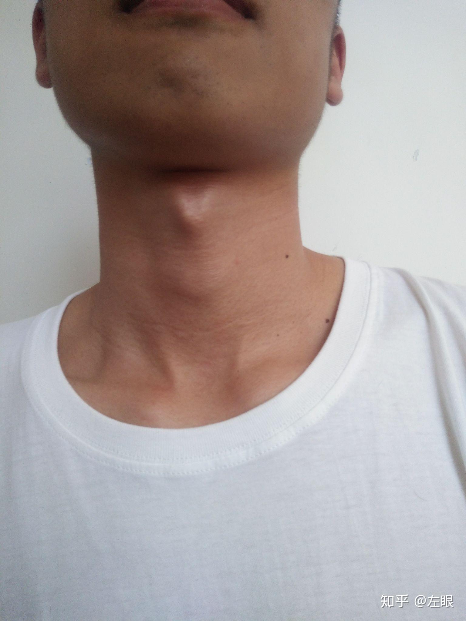 成年男性喉结图片