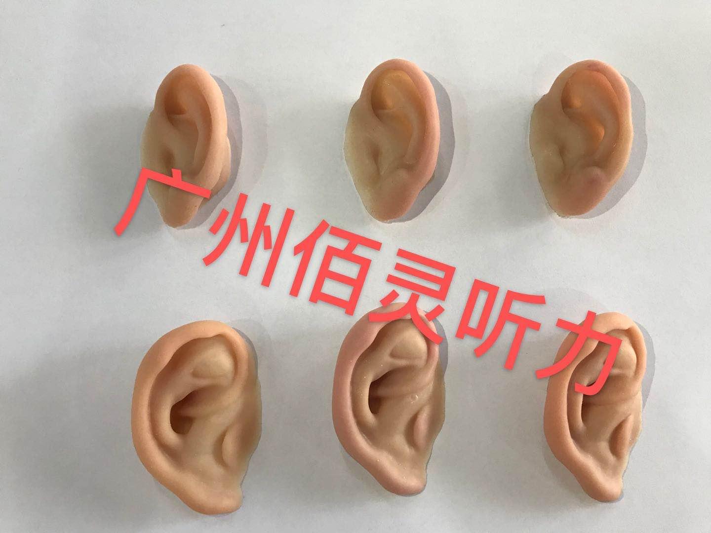 先天性小耳畸形的听力干预 - 知乎