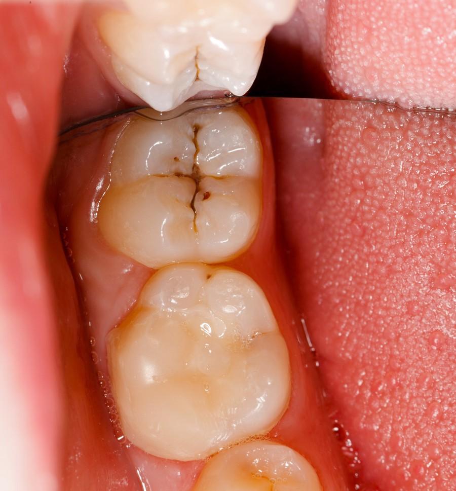 女性备孕和怀孕都要掌握的口腔保健知识! - 知乎