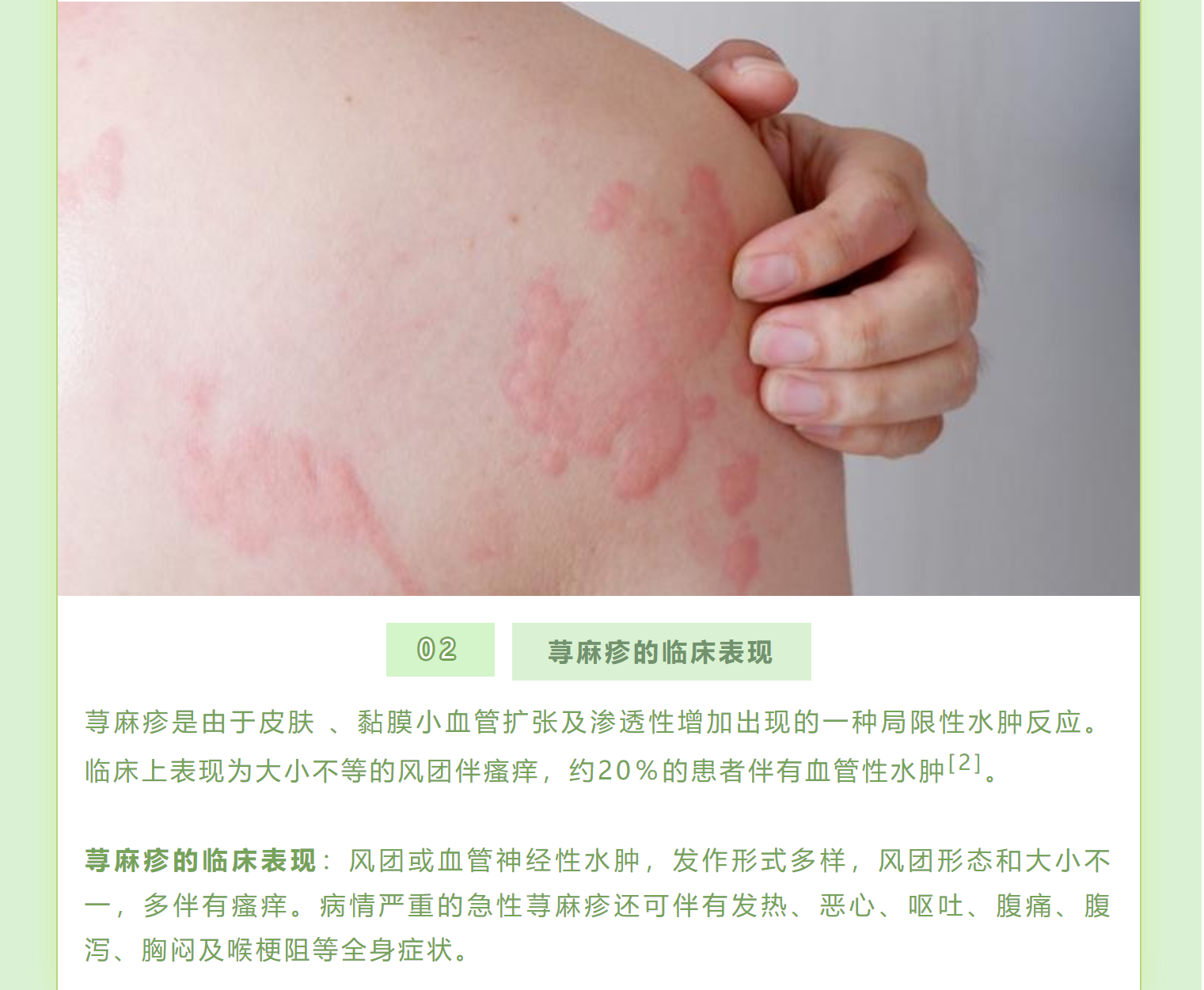麻疹的预防设计图__展板模板_广告设计_设计图库_昵图网nipic.com