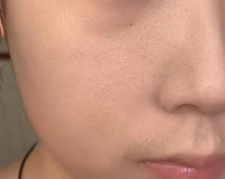 干皮应该如何护肤? - 知乎