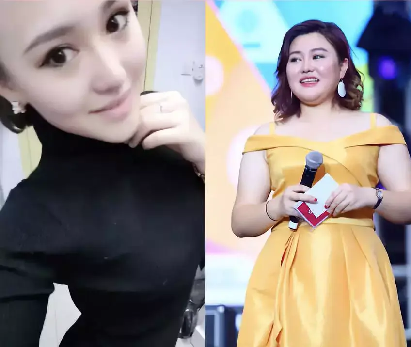 暴肥60斤后这个女演员被送上手术台一个人不自律任谁都救不了