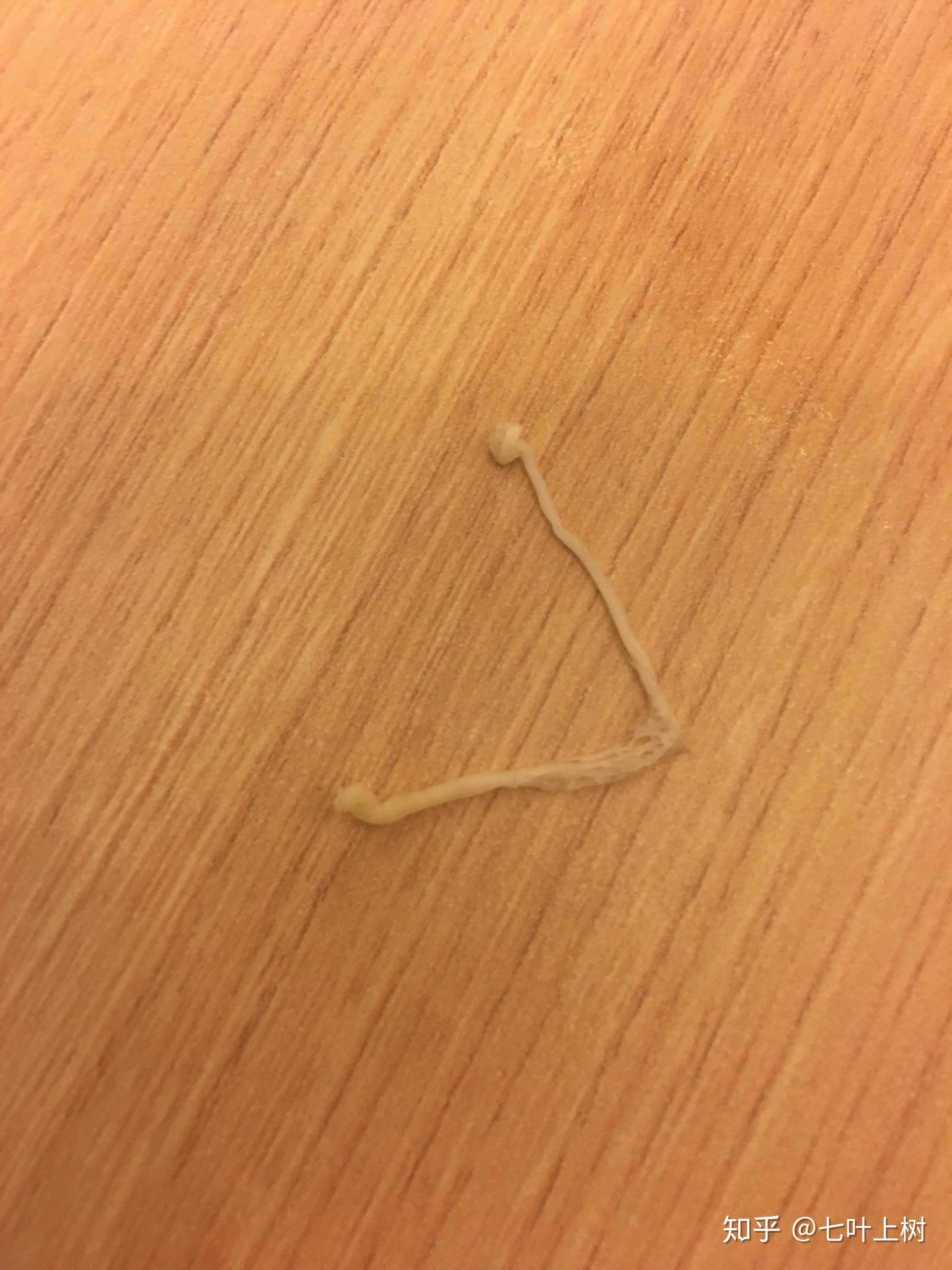 鱼肉里的寄生虫