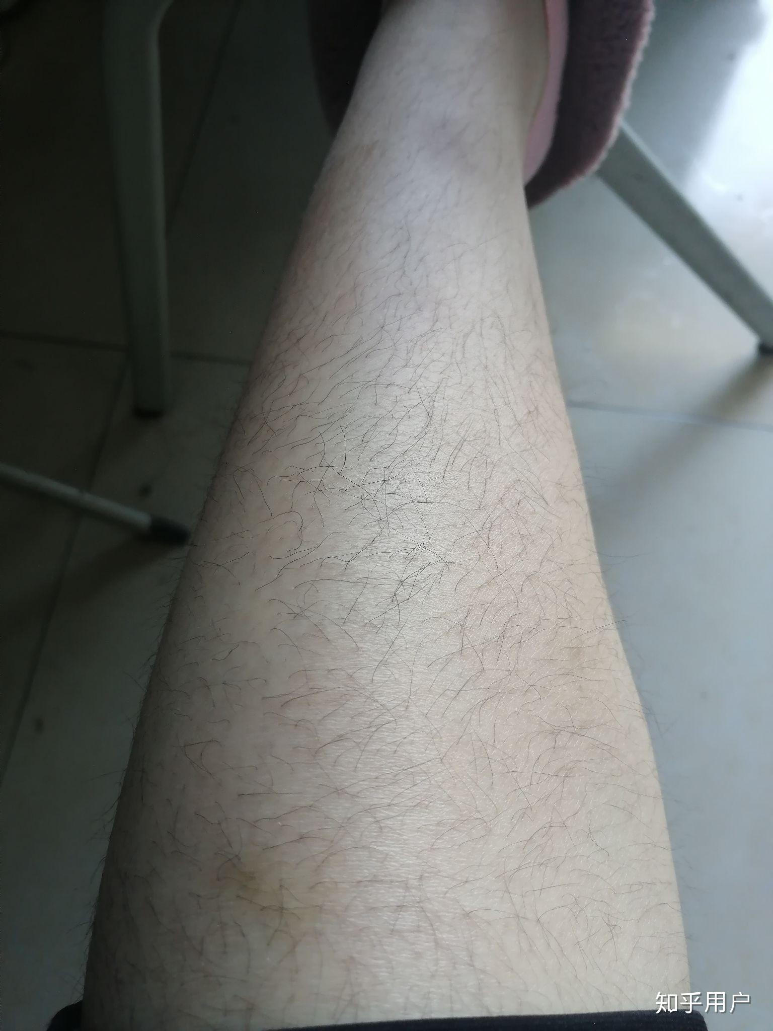 女生体毛多是种怎样的体验