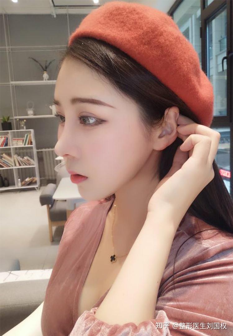 医生面对"网红鼻"要求,怎么处理? - 知乎