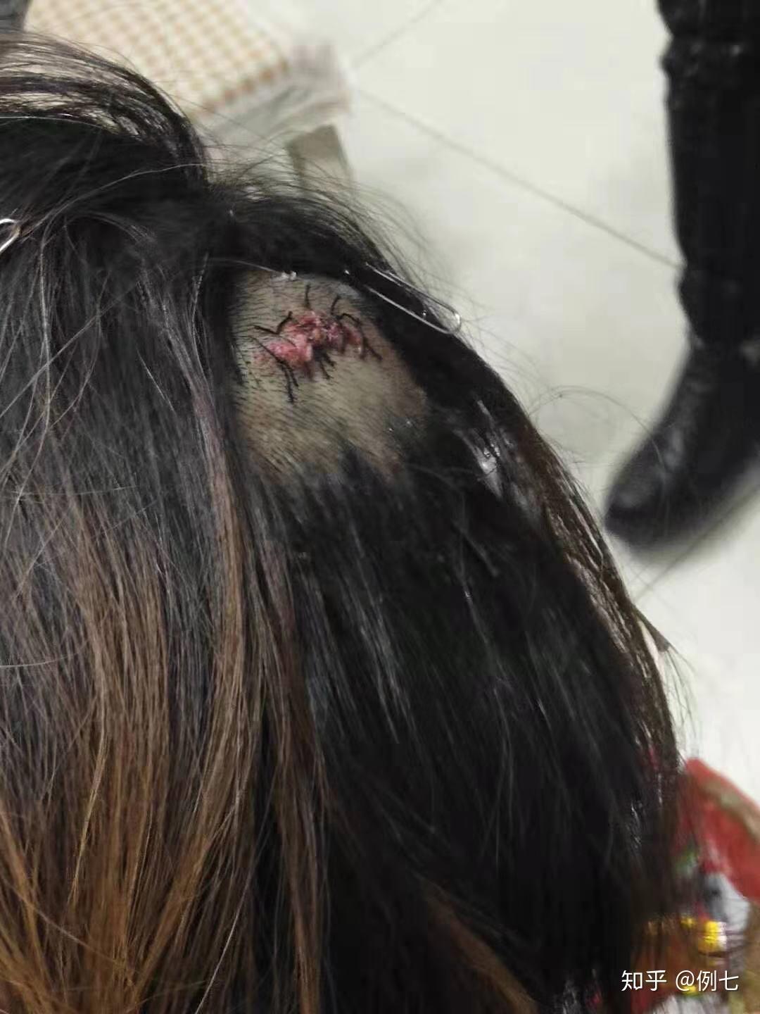 电车撞人逃逸寻人启事还是当代办案程序到哪一步算结束