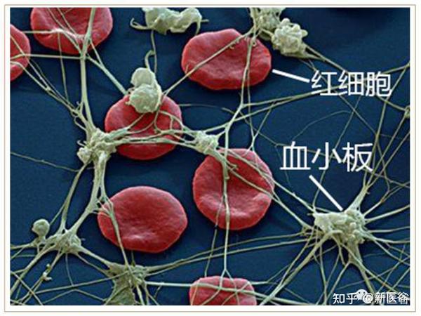 谷谷科普|血小板从何来，长啥样，有何用？ - 知乎