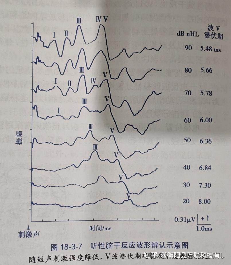 什么是ABR?如何看懂ABR报告? - 知乎