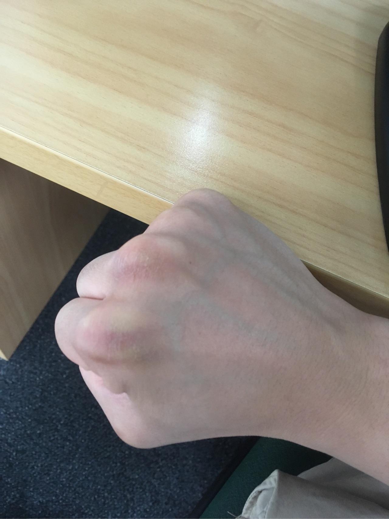 大家的拳茧都啥样了,想见见? - 知乎