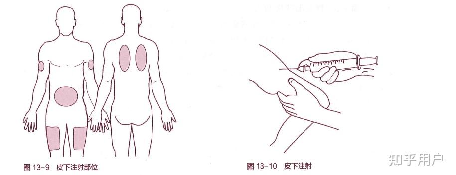 皮下注射皮内注射和肌肉注射的区别