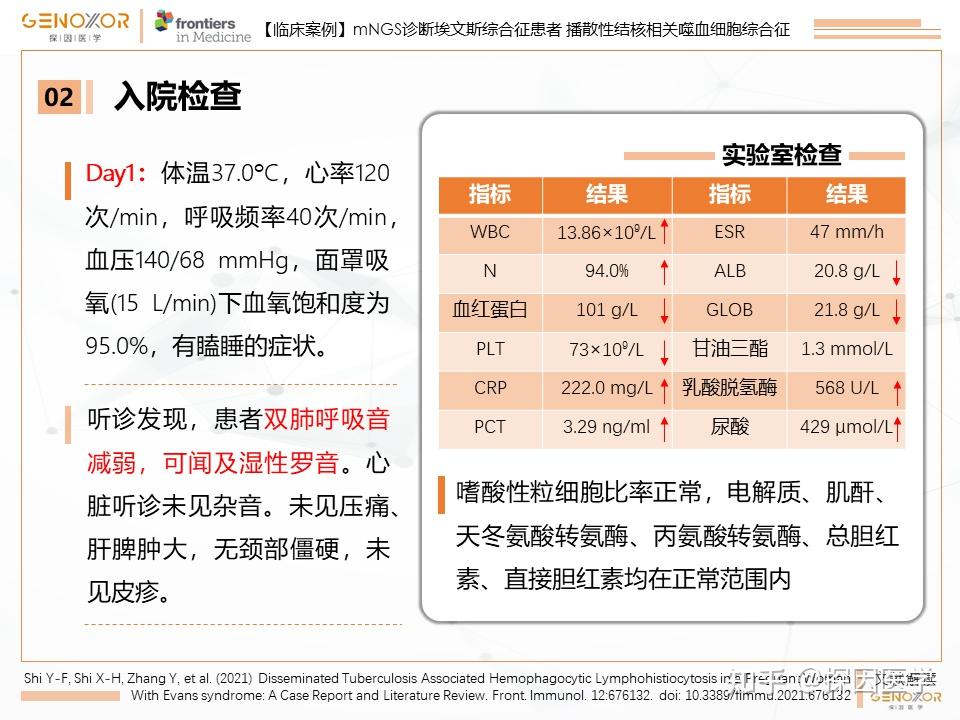 病例报告播散性结核相关噬血细胞综合征1例