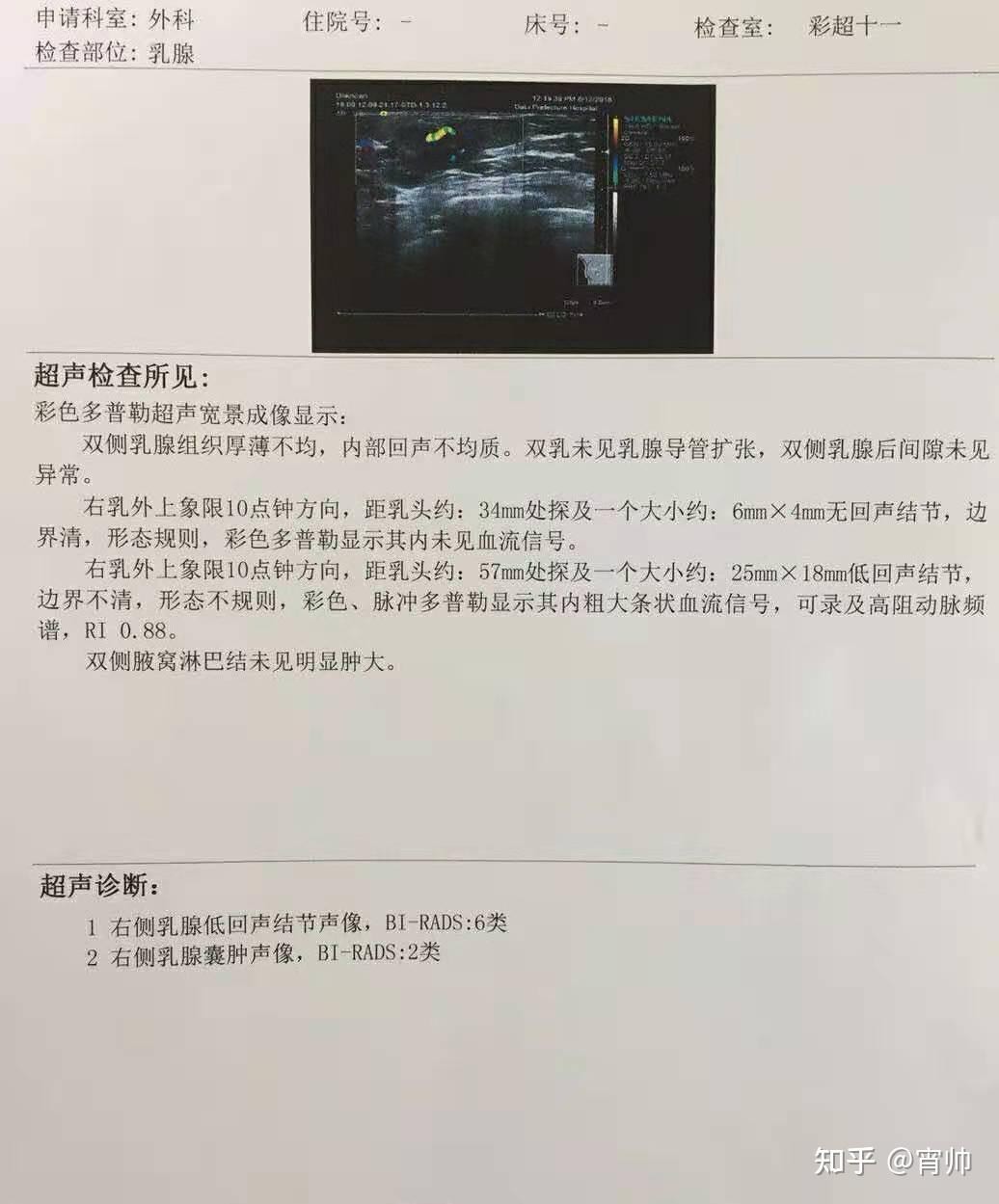 乳腺癌早期望好