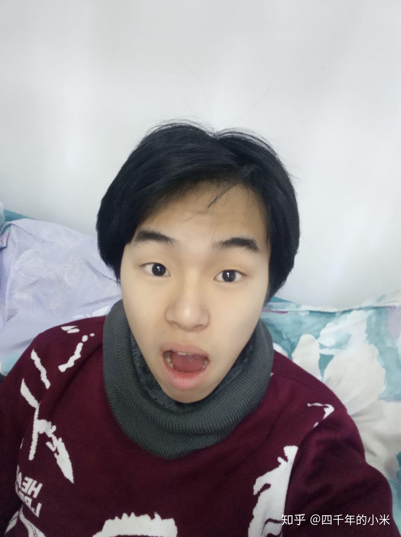 牙齿地包天兜齿是怎样的一种体验