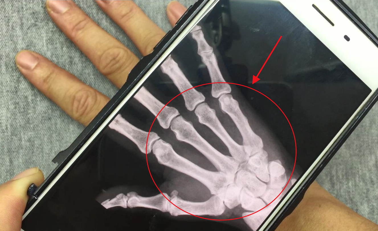 设置这里,手机就具有透视功能!女友的手掌骨头可以看到一清二楚