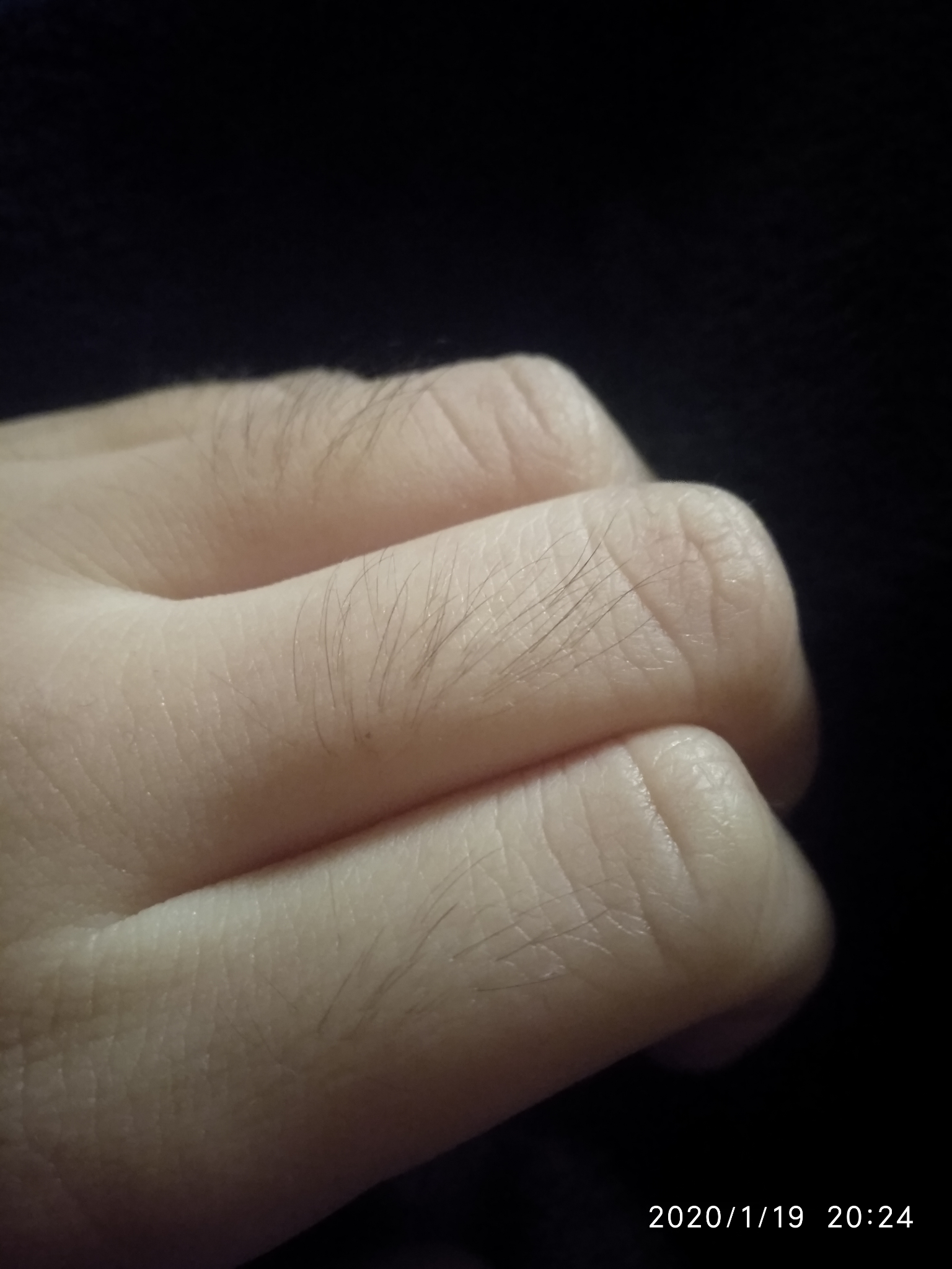 手指上长毛是一种什么样的体验? - 知乎