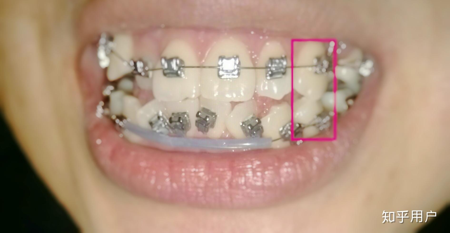 v2-ec744137da339e20129e349ece35224c_r.jpg