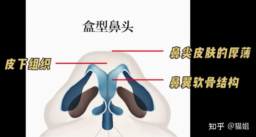 拥有盒型鼻头是一种什么体验? - 知乎