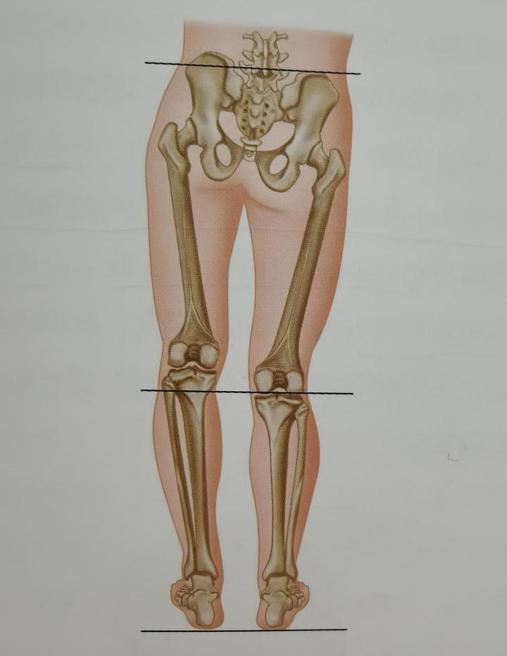 长短腿骨盆侧倾图片图片