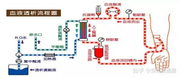 血液透析——基础知识 - 知乎