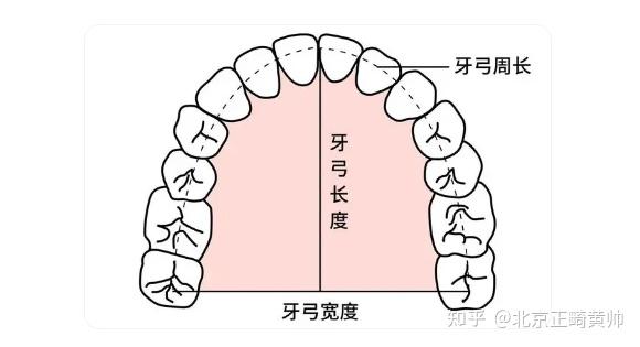 骨性扩弓 VS 牙性扩弓,到底扩的是哪里? - 知乎