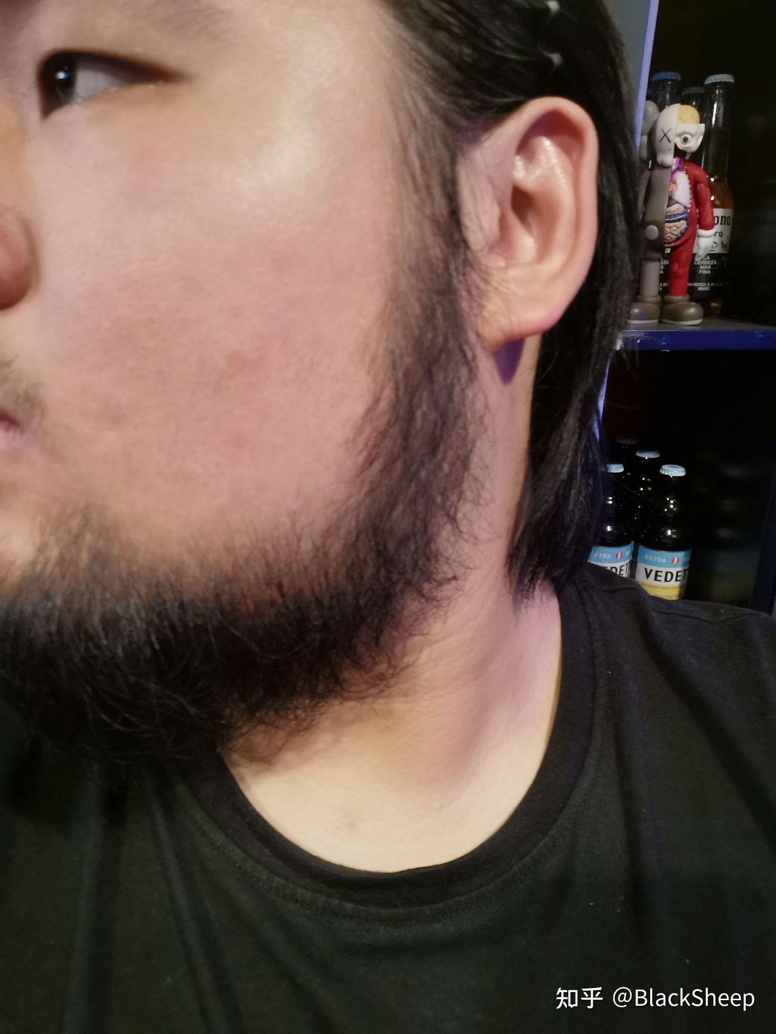 很喜欢络腮胡,向同志们请教一下我适不适合留胡子怎么才能长络腮胡?