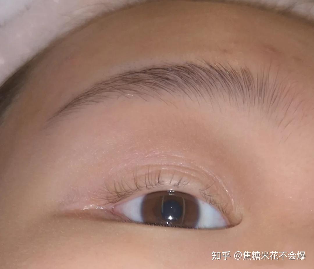 有什么真的有效的睫毛增长液