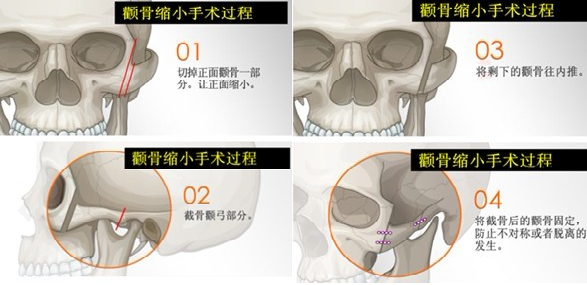 如何判断一个人的颧骨是高还是低? - 知乎
