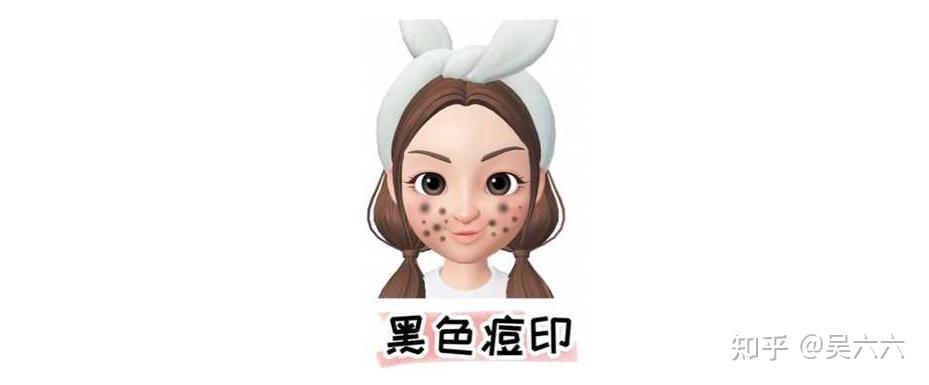 怎么样可以去除痘印? - 知乎