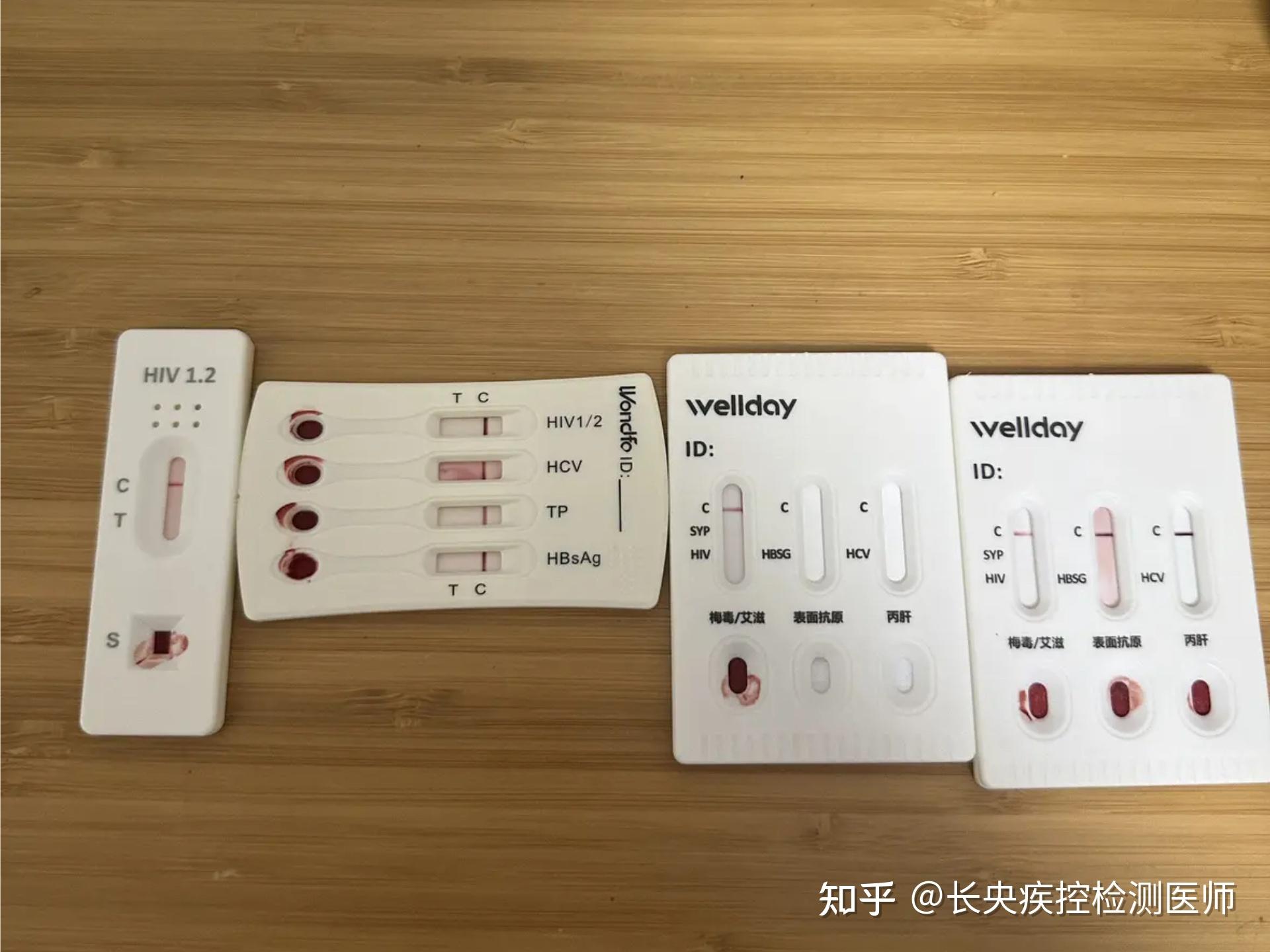 hiv自测可以完全排除了吗?